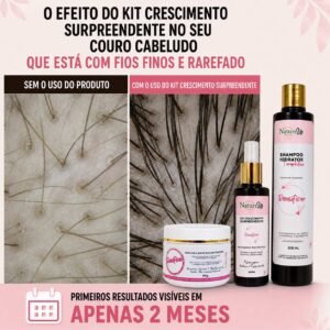 Kit Crescimento Surpreendente - kit de Crescimento Capilar para tratar queda calvície e entradas com máscara para couro e fio 8 IMG 4557
