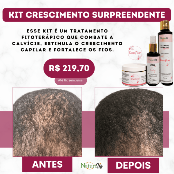 kit crescimento capilar
